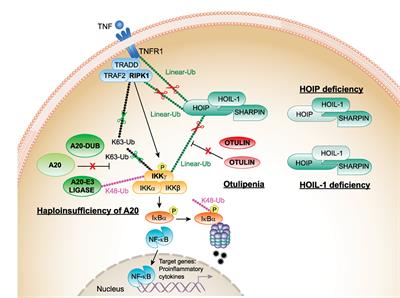 NF-κB Pathway in Autoinflammatory Diseases: Dysregulation of Protein Modifications by Ubiquitin Defines a New Category of Autoinflammatory Diseases